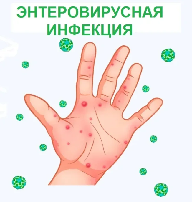 Наталья Некрасова провела обучающее занятие по энтеровирусной инфекции на медицинской конференции на нашего Центра.