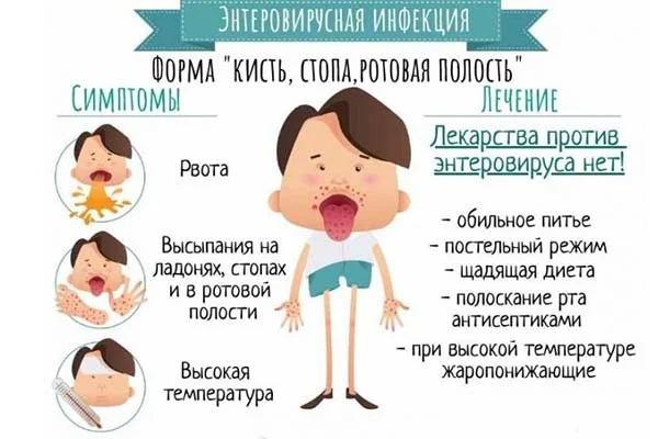 Профилактика энтеровирусной инфекции при выезде за границу