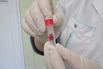 В регионе обсудят вопросы борьбы с гепатитом С В регионе обсудят вопросы борьбы с гепатитом С